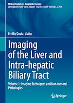 Télécharger le livre :  Imaging of the Liver and Intra-hepatic Biliary Tract