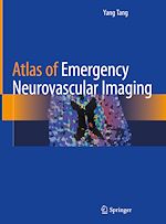 Télécharger le livre :  Atlas of Emergency Neurovascular Imaging