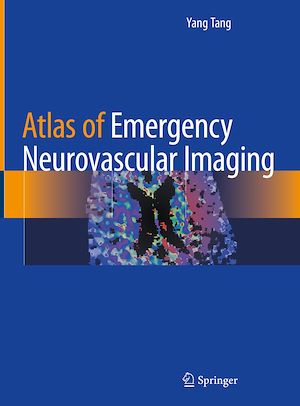 Téléchargez le livre :  Atlas of Emergency Neurovascular Imaging