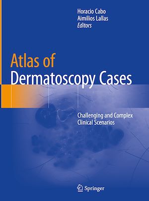 Téléchargez le livre :  Atlas of Dermatoscopy Cases