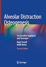 Télécharger le livre :  Alveolar Distraction Osteogenesis