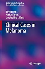 Télécharger le livre :  Clinical Cases in Melanoma