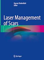 Télécharger le livre :  Laser Management of Scars