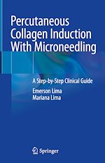Télécharger le livre :  Percutaneous Collagen Induction With Microneedling