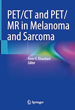 Télécharger le livre :  PET/CT and PET/MR in Melanoma and Sarcoma