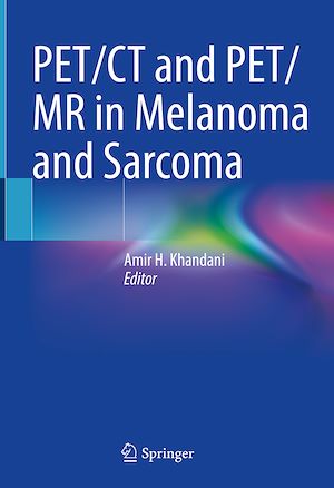 Téléchargez le livre :  PET/CT and PET/MR in Melanoma and Sarcoma