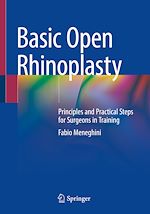 Télécharger le livre :  Basic Open Rhinoplasty