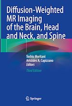 Télécharger le livre :  Diffusion-Weighted MR Imaging of the Brain, Head and Neck, and Spine