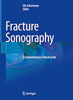 Télécharger le livre :  Fracture Sonography