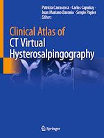 Télécharger le livre :  Clinical Atlas of CT Virtual Hysterosalpingography