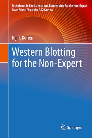 Téléchargez le livre :  Western Blotting for the Non-Expert