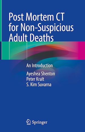 Télécharger le livre :  Post Mortem CT for Non-Suspicious Adult Deaths