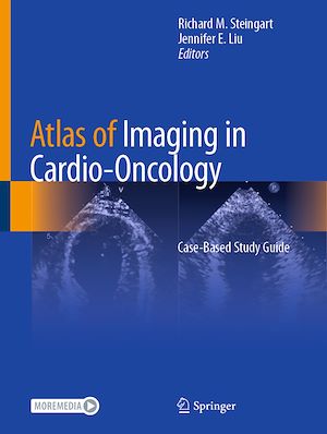 Téléchargez le livre :  Atlas of Imaging in Cardio-Oncology