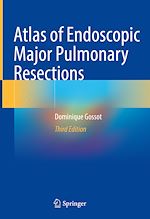 Télécharger le livre :  Atlas of Endoscopic Major Pulmonary Resections