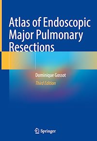 Télécharger le livre :  Atlas of Endoscopic Major Pulmonary Resections