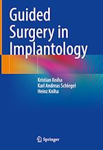 Télécharger le livre :  Guided Surgery in Implantology