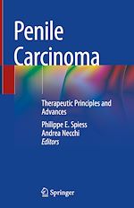 Télécharger le livre :  Penile Carcinoma