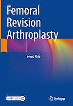 Télécharger le livre :  Femoral Revision Arthroplasty