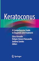 Télécharger le livre :  Keratoconus