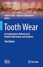 Télécharger le livre :  Tooth Wear