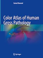 Télécharger le livre :  Color Atlas of Human Gross Pathology