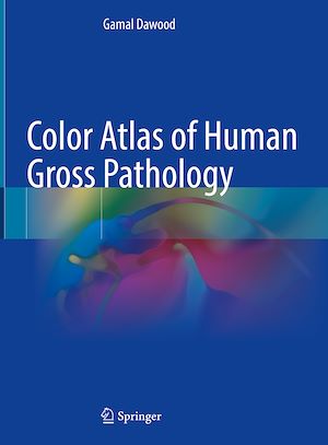 Téléchargez le livre :  Color Atlas of Human Gross Pathology