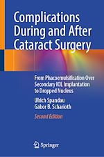 Télécharger le livre :  Complications During and After Cataract Surgery