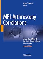 Télécharger le livre :  MRI-Arthroscopy Correlations