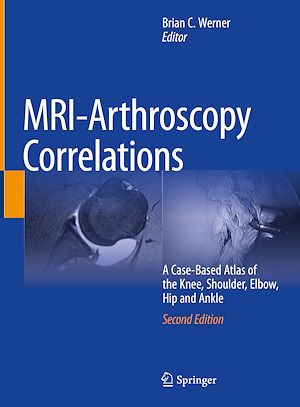 Téléchargez le livre :  MRI-Arthroscopy Correlations