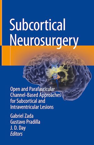 Téléchargez le livre :  Subcortical Neurosurgery