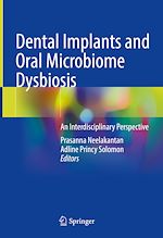 Télécharger le livre :  Dental Implants and Oral Microbiome Dysbiosis