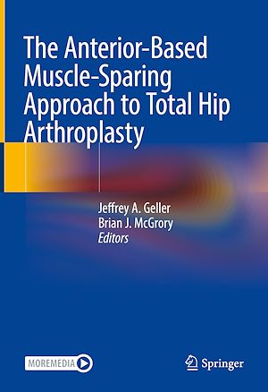 Téléchargez le livre :  The Anterior-Based Muscle-Sparing Approach to Total Hip Arthroplasty
