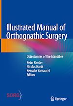 Télécharger le livre :  Illustrated Manual of Orthognathic Surgery