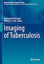 Télécharger le livre :  Imaging of Tuberculosis