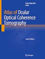Télécharger le livre :  Atlas of Ocular Optical Coherence Tomography