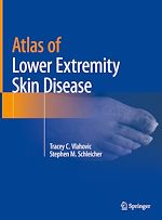 Télécharger le livre :  Atlas of Lower Extremity Skin Disease