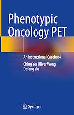 Télécharger le livre :  Phenotypic Oncology PET