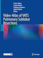Télécharger le livre :  Video-Atlas of VATS Pulmonary Sublobar Resections