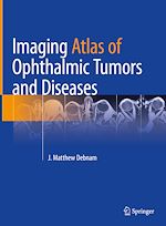 Télécharger le livre :  Imaging Atlas of Ophthalmic Tumors and Diseases