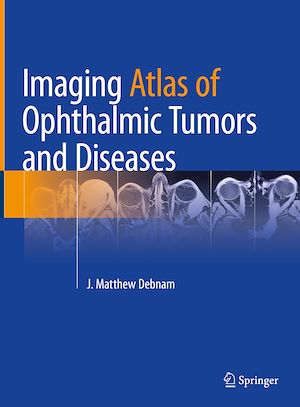 Téléchargez le livre :  Imaging Atlas of Ophthalmic Tumors and Diseases