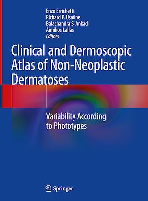Téléchargez le livre :  Clinical and Dermoscopic Atlas of Non-Neoplastic Dermatoses
