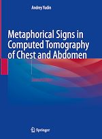Télécharger le livre :  Metaphorical Signs in Computed Tomography of Chest and Abdomen