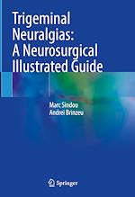 Télécharger le livre :  Trigeminal Neuralgias: A Neurosurgical Illustrated Guide
