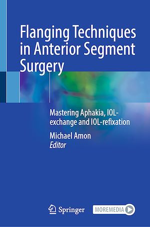 Téléchargez le livre :  Flanging Techniques in Anterior Segment Surgery