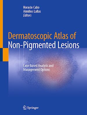 Téléchargez le livre :  Dermatoscopic Atlas of Non-Pigmented Lesions