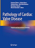 Télécharger le livre :  Pathology of Cardiac Valve Disease