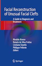 Télécharger le livre :  Facial Reconstruction of Unusual Facial Clefts