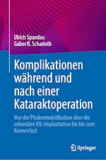 Télécharger le livre :  Komplikationen während und nach einer Kataraktoperation