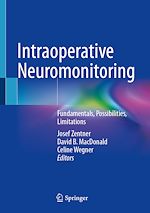 Télécharger le livre :  Intraoperative Neuromonitoring