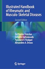 Télécharger le livre :  Illustrated Handbook of Rheumatic and Musculo-Skeletal Diseases